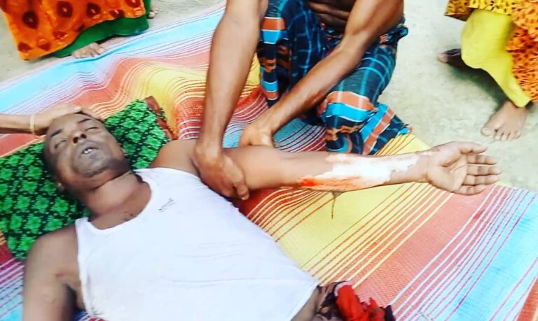 শেরপুরে মোবাইল কোর্টে কারেন্ট জাল পুড়তে গিয়ে ৩ জেলের গায়ে আগুন। দুই ঘণ্টা অবরুদ্ধ ম্যাজিস্ট্রেট-পুলিশ।