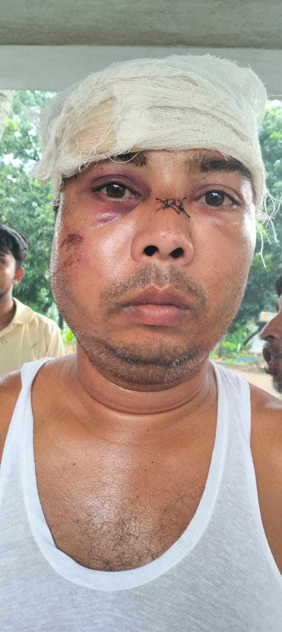 শেরপুরে দুর্বৃত্তের হামলায়  শিক্ষক আহত