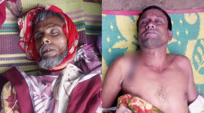 শেরপুরে বিদ্যুৎস্পৃষ্টে প্রাণ গেলো দুইজনের